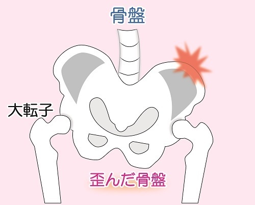 骨盤を支える 大腰筋 体質改善ブログ