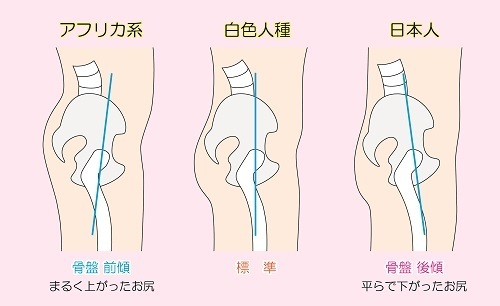 小尻 になりたい 体質改善ブログ